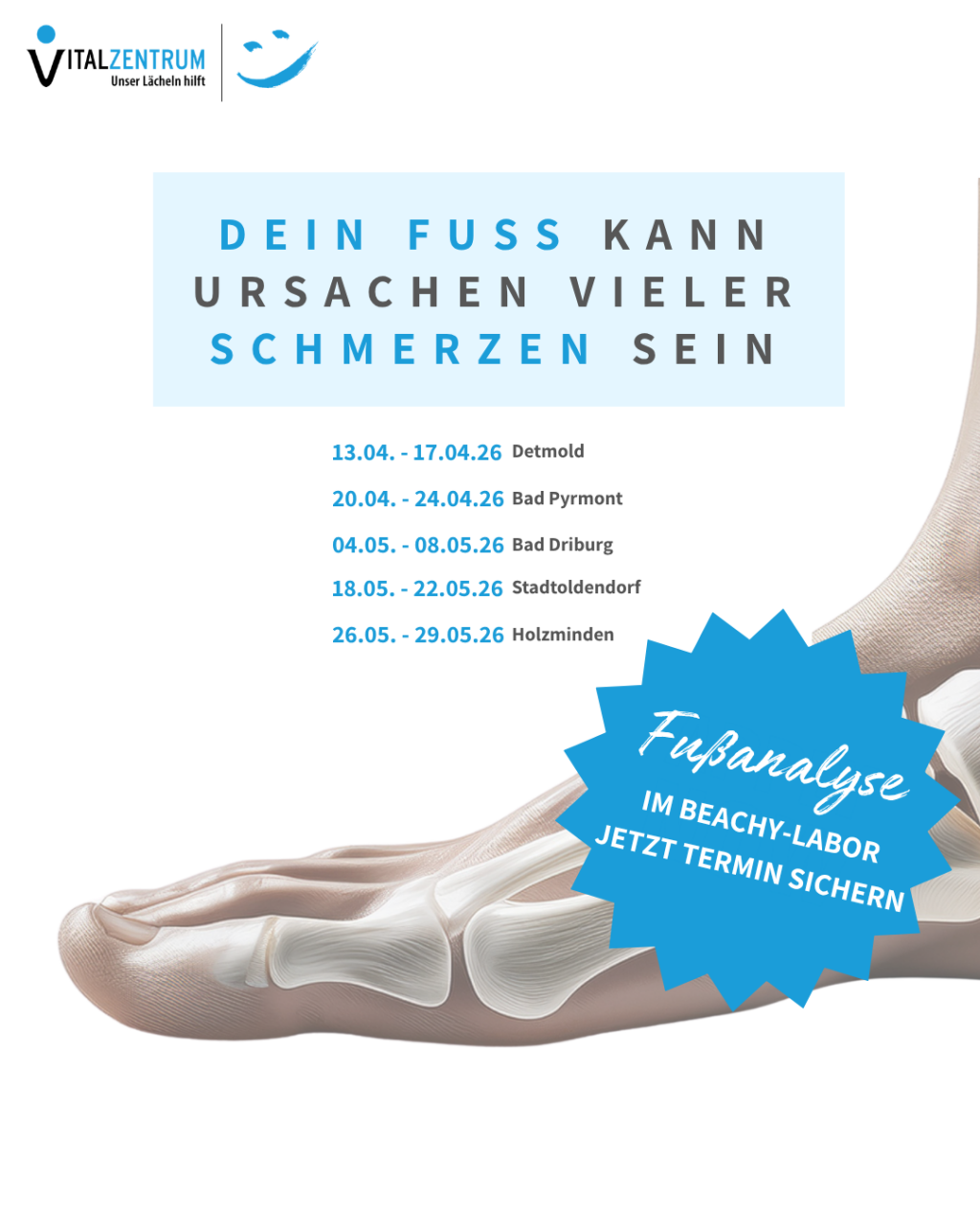 Beachy on Tour 2026 – Digitale Fußanalyse direkt vor Ort!